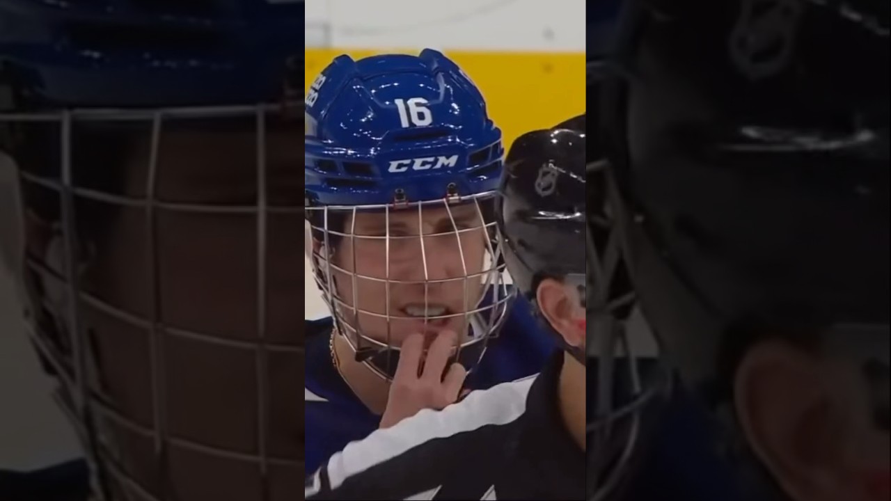 Mitch Marner Takes A Puck To The Face And Returns With A New Accessory 😬