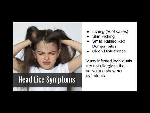 How do I know if I have lice?