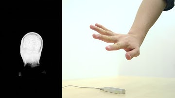 Manipulating 3D medical images with gesture control