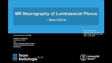 Plexus MRI – How I do it