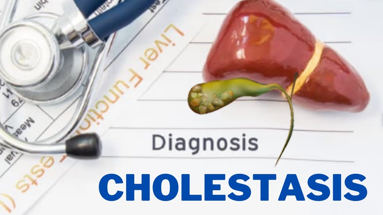Cholestasis What triggers cholestasis? 247nht YouTube