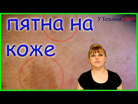 ИЗБАВЬСЯ от темных пятен на КОЖЕ!