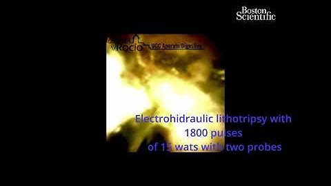 Electrohidraulic Lithotripsy