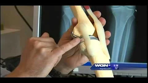 Dr. Craig Della Valle of Midwest Orthopaedics at R...