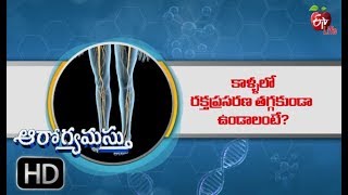 Peripheral Artery Disease in legs | Aarogyamastu | 4th September 2019 | ETV Life