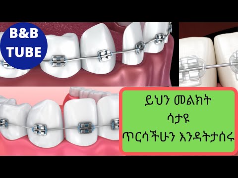 ቪዲዮ: በሕክምና ውስጥ በኋላ ምን አለ?