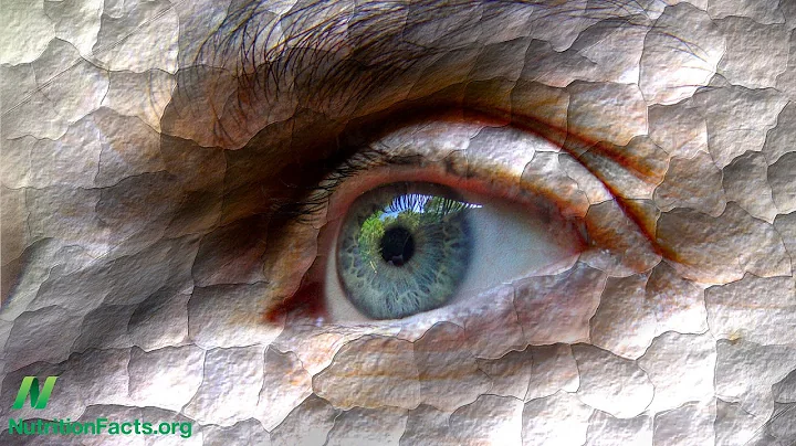 Treating Dry Eye Disease with Diet: Just Add Water?