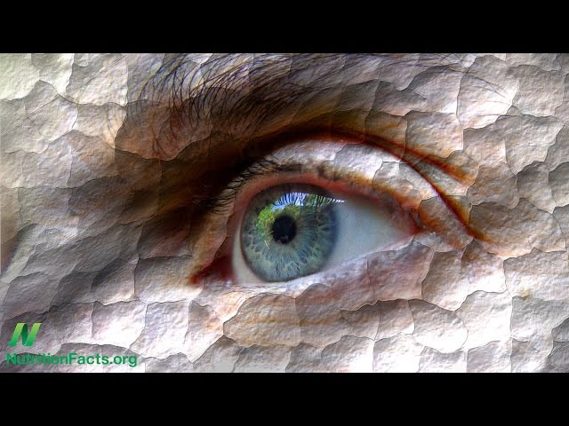 Treating Dry Eye Disease with Diet: Just Add Water?