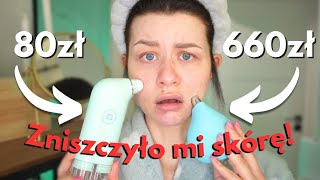 Mam całą siną skórę! Test DROGIEGO odkurzacza do pryszczy od FOREO! Dramat!!!