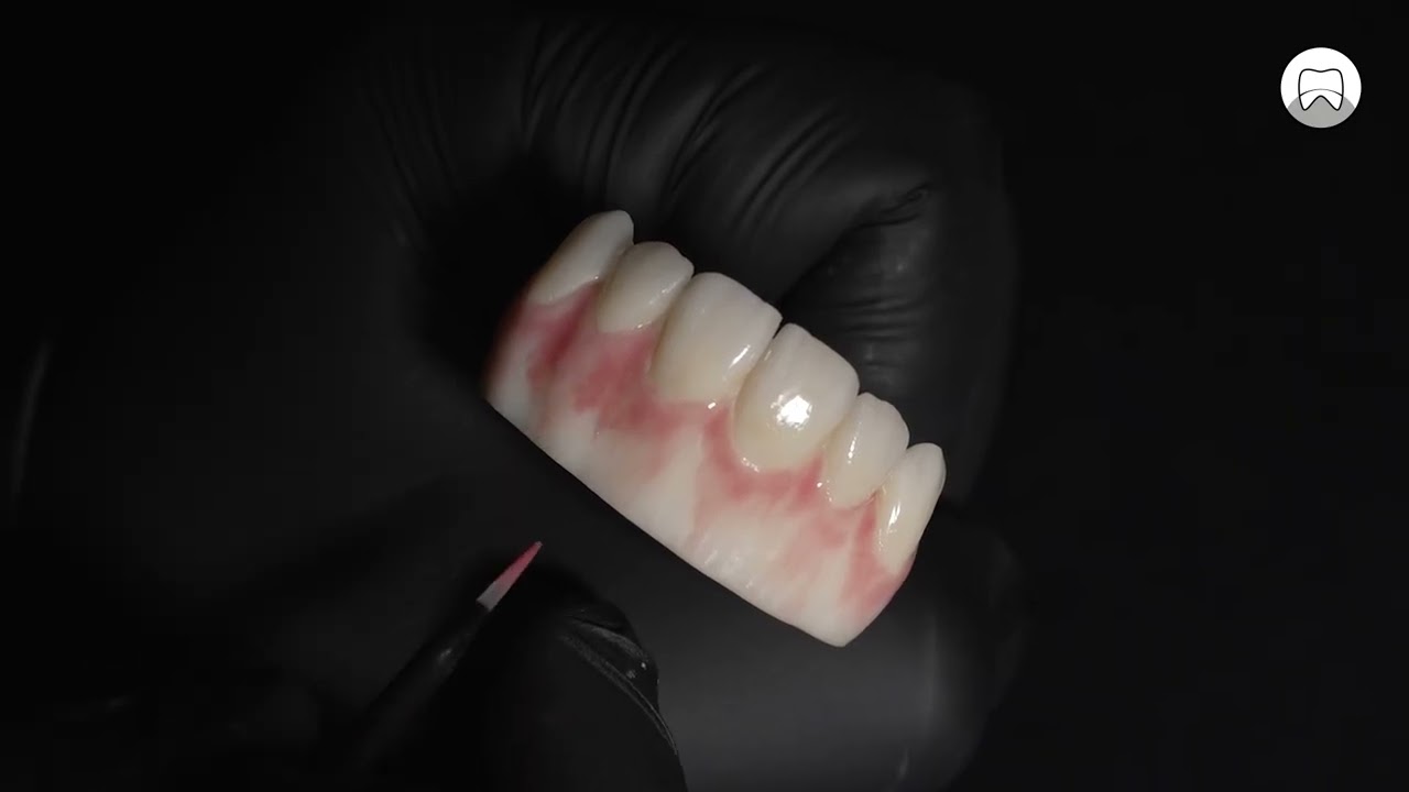 Finitura estetica rosa e bianca con le masse HeraCeram cre-active