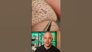 Derm reacts to stubborn ingrown hair removal! #dermreacts #doctorreacts #ingrownhair