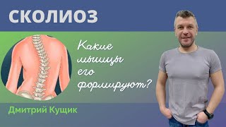 СКОЛИОЗ | Мышцы, которые могут формировать сколиоз | Кинезиолог Дмитрий Кущик