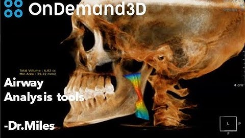 Airway analysis tools in OnDemand3D software