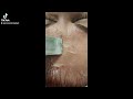 Curățarea tenului cu peeling enzimatic cu pere și lava vulcanică! apoi am aplicat skin scrubber!