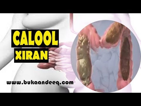 calool xiran | saxarada oo ku adkaata qofka | constipation