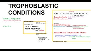Pathology 750 a Placenta Tumor Hydatidiform mole complete partial molar pregnancy ChorioCarcinoma