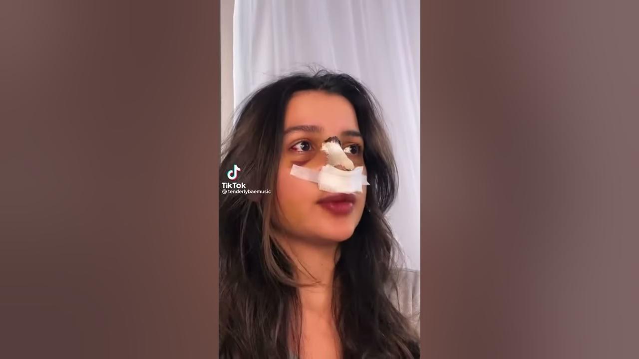Амина Тендерлибае снимает гипс после операции на нос - YouTube