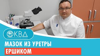 Мазок из уретры ершиком. Клинический случай №144