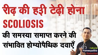 रीढ़ की हड्डी टेढ़ी होना || Scoliosis || Curvature spine || Natural homeopathic remedies symptoms