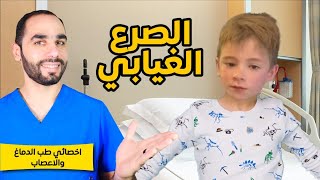 نوبات الصرع الصافن: العلاج الصحيح