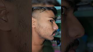 my 3 months result of Minoxidil 5% for beards 🧔 ||beard journey||minoxidil video||satisfaction 😁|| screenshot 4