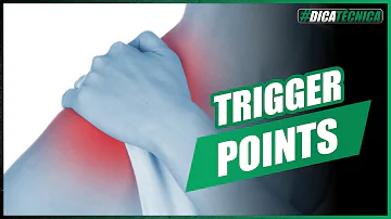O que são os trigger points?