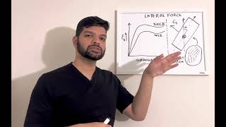 What is Lateral Force?