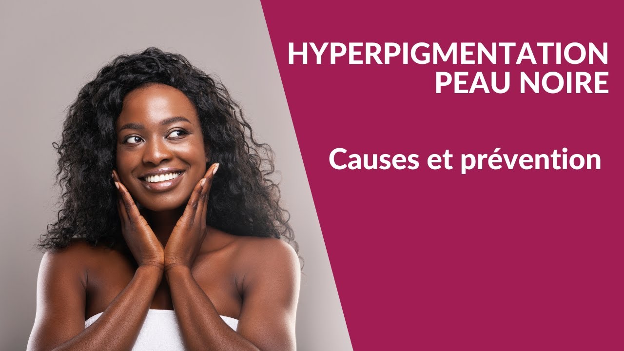 Hyperpigmentation peau noire : causes et prévention