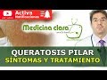 Queratosis pilar | Granos en brazos y piernas | Medicina Clara con el Dr. Bueno