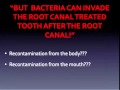 Holisitc Root Canal Therapy and RCT Alternatives