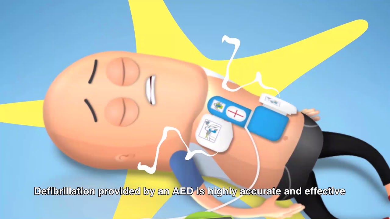 Sudden Cardiac Arrest - Part 3