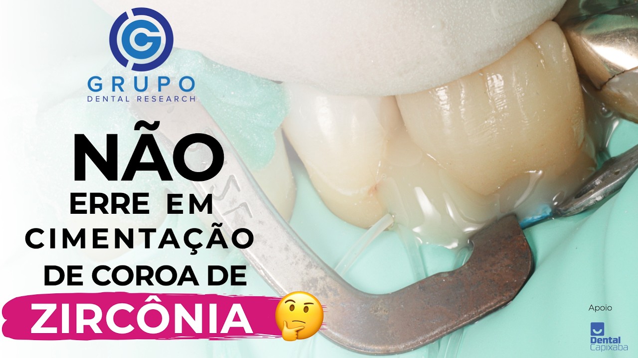 🔬 Como Cimentar coroa de Zircônia Y-TZP Corretamente? Passo a Passo com Panavia V5 da Kuraray - GDR