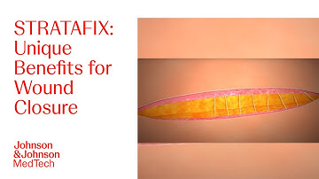 STRATAFIX Spiral Bidirectional Regular and Dual Layer Closure Techniques | J&J MedTech