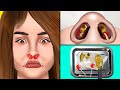 Asmr treatment  removal of a lollipop stuck in nose  asmr care animation  jinjja  asmr