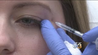 Botox: Why Doctors Are Seeing A Rise In Younger Patients