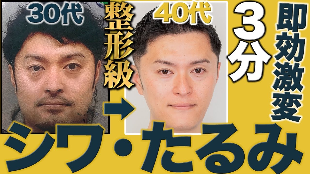 Старое лицо Оборудование для лица Мелкая коррекция лица Тонкие дряблые морщины лица