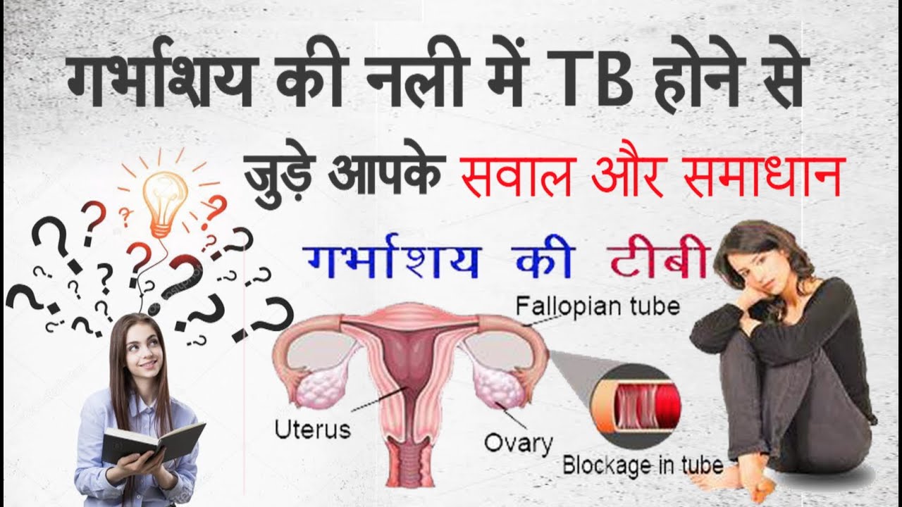 TB in Fallopian Tube - गर्भाशय की नाली में टीबी की जांच एवं उपचार से जुड़े आपके सवाल |