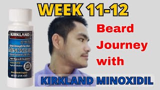 Week  11 - 12 My Beard Journey with Kirkland Minoxidil beardgrowth Minoxidil Kirkland Howto