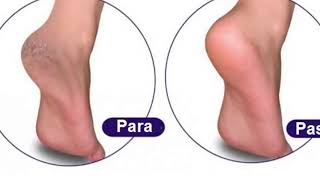 Si Ti Shëroni Thembrat E Çara Në Mënyrë Natyrale Me 2 Perberes