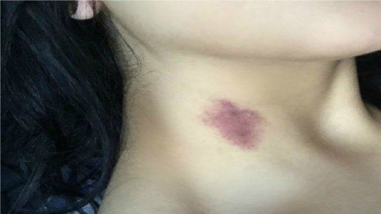how to give a hickey naturally on the neck - YouTube