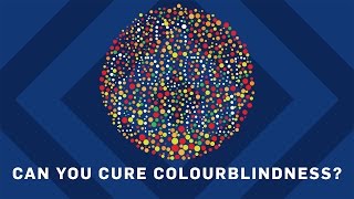 Can You Cure Colourblindness? | Brit Lab Can You Cure Colourblindness? | Brit Lab