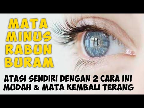 Video: Sama Ada Gadis, Atau Penglihatan - Pandangan Alternatif