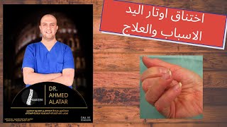 اختناق اوتار اليد الاسباب والعلاج - د احمد العطار
