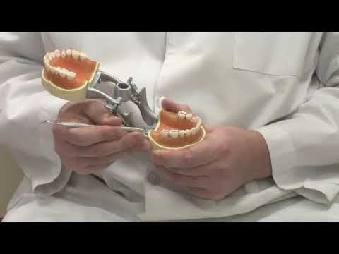 Advantages of Gold Dental Fillings - YouTube