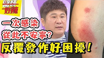 皮膚炎 Youtube