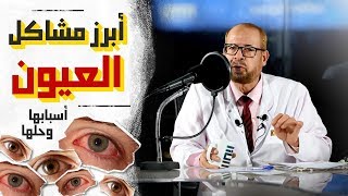 افرازات العين وعلاجها