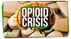 Why Is There an Opioid Crisis?