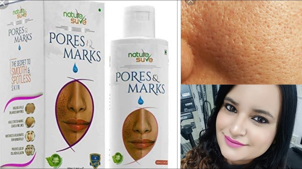 BEST TREATMENT FOR OPEN PORES/100% Natural/Nature Sure Pores Oil - YouTube