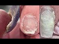 Супер клей РАЗЪЕЛ ноготь 😱 Быстрое наращивание / Маникюр / Китайская роспись на ногтях