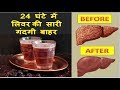 मात्र 24 घंटे में लिवर की सारी गंदगी को बाहर निकाले / हर बीमारी से बचे HOW TO CLEANSE YOUR LIVER ?